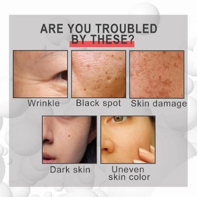 Krema protiv bora i mrlja | 30ml serum za kolagen