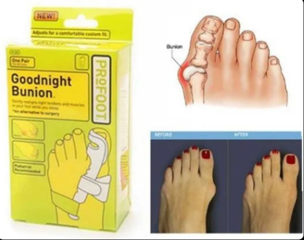 longeta-za-ispravljanje-cukljeva-okshop-1-1.png Longeta za ispravljanje čukljeva | Korekcija Hallux Valgus