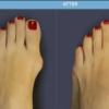 longeta-za-ispravljanje-cukljeva-okshop-2.png Longeta za ispravljanje čukljeva | Korekcija Hallux Valgus