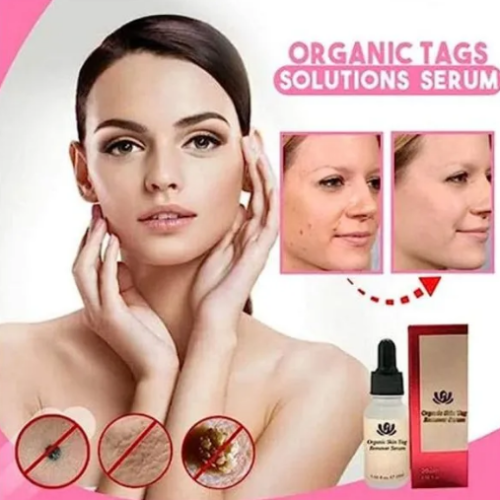 Bočica Organic Solutions seruma za uklanjanje fleka na koži, prirodno rešenje.