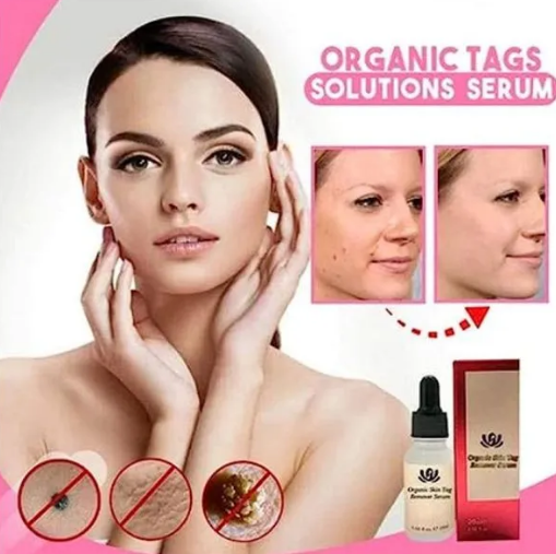 Bočica Organic Solutions seruma za uklanjanje fleka na koži, prirodno rešenje.
